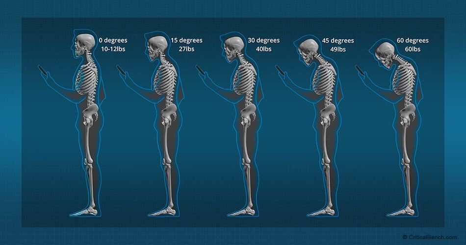 Is Forward Head Posture Correctable? Experts Reveal the Truth