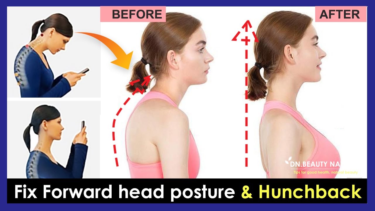 Effective Ways to Relieve Neck Pain Caused by Poor Posture